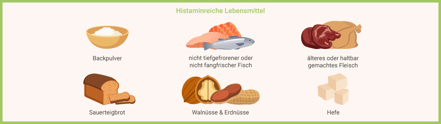 Infografik: Histaminreiche Lebensmittel