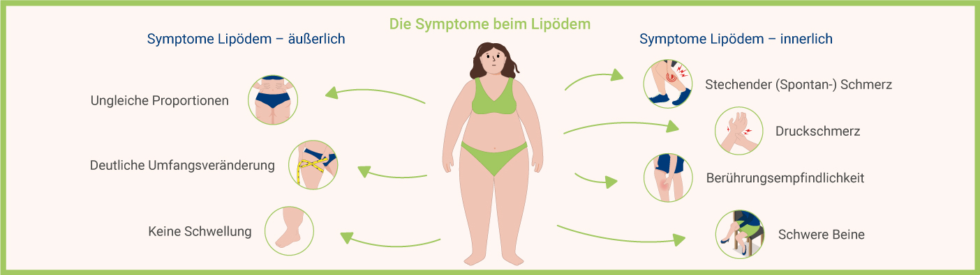 Infografik: Symptome Lipödem